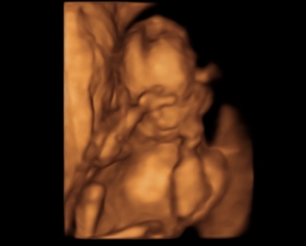 Scan photo - Would you be worried