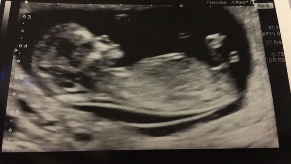 September 2019 Babies - Thread #3