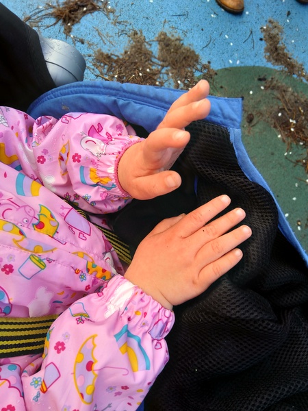 Red puffy sore hands in 3 year old.