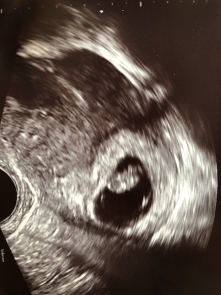 October 2019 thread 2