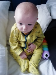 Red blotches in babies face and chest while feeding.