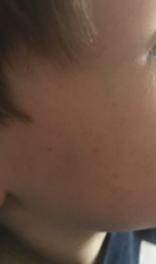 Strange faint rash