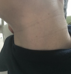 Strange faint rash