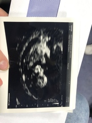 Gender guess 💙💗