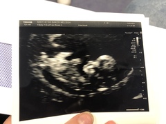 Gender guess 💙💗