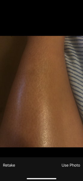 Help me fix my weird shins!