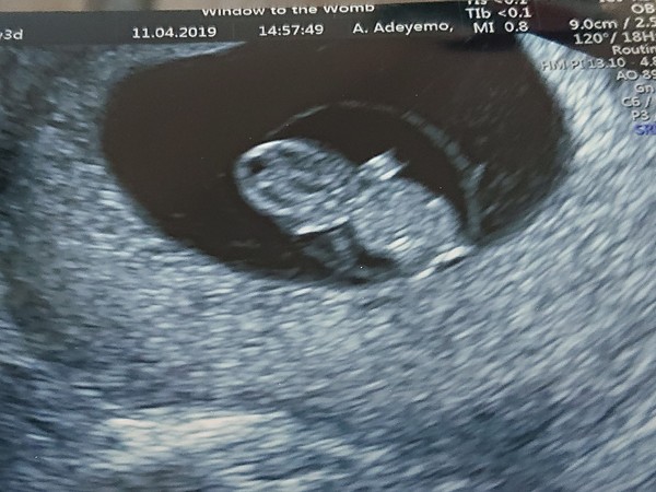 Due November 2019 Thread 3