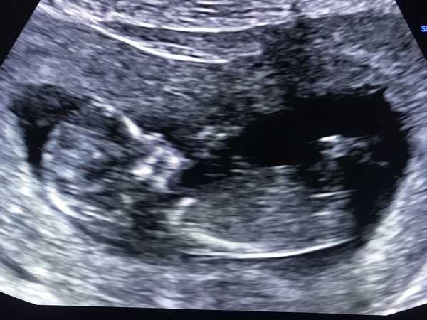 Gender guess!