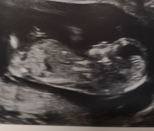 October 2019 thread 2