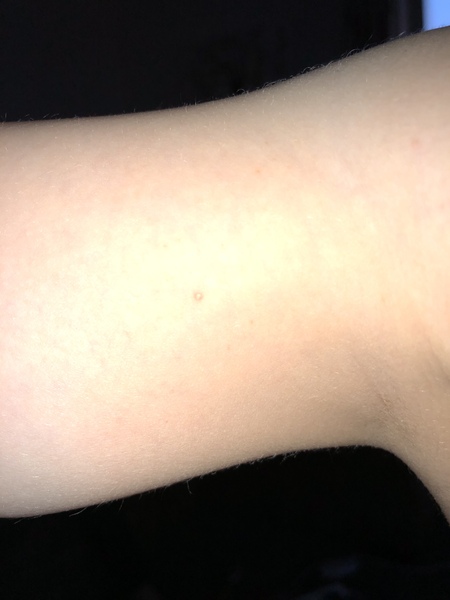 Does anyone know what the spots are on my son?