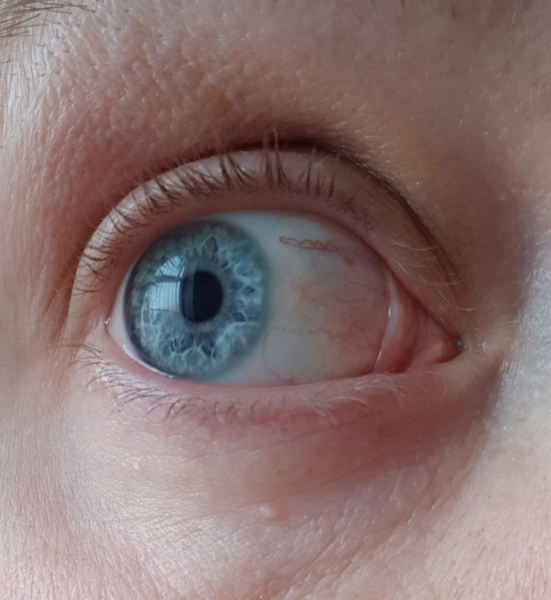 I want to ask "what colour are these eyes?"