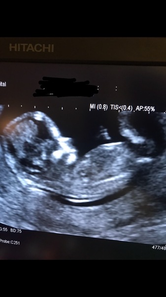 Gender guesses