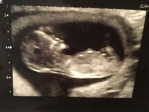 Gender guesses for fun!!!