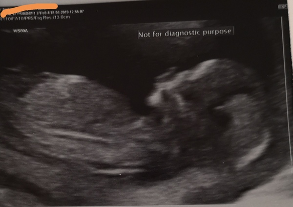 Gender guesses??