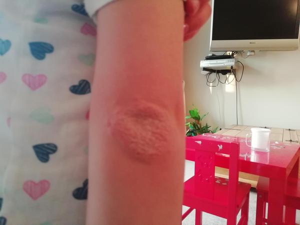 Painful elbow - any ideas?