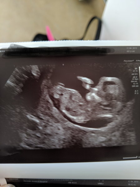 Girl or Boy? Anyone care to guess?