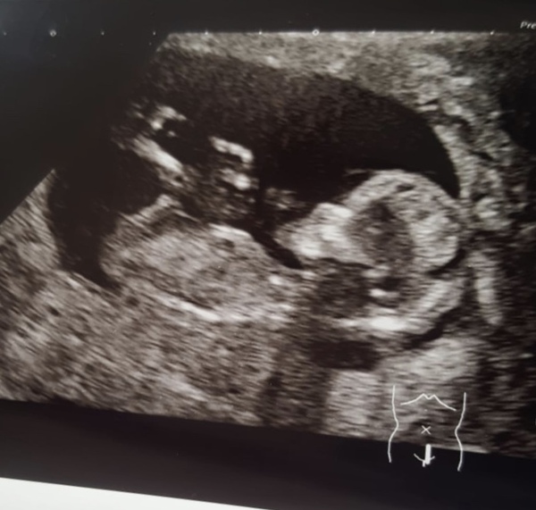 Due November 2019 Thread 4