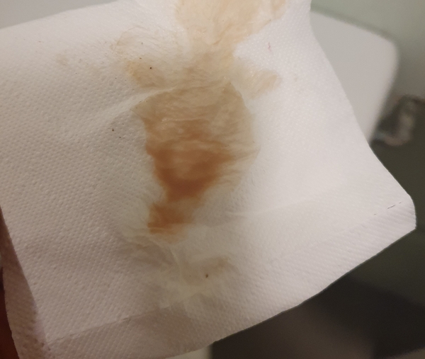 Implantation bleeding - help