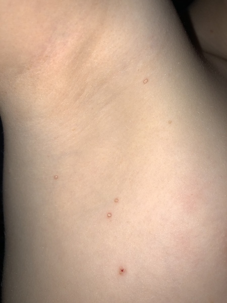 Does anyone know what the spots are on my son?