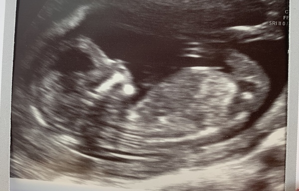 Gender guess?