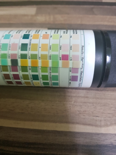 protein in urine *pic attached*