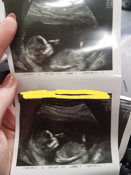 Any guesses on Gender 😍 ?