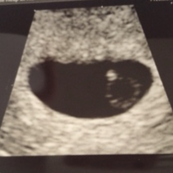 Due December 2019