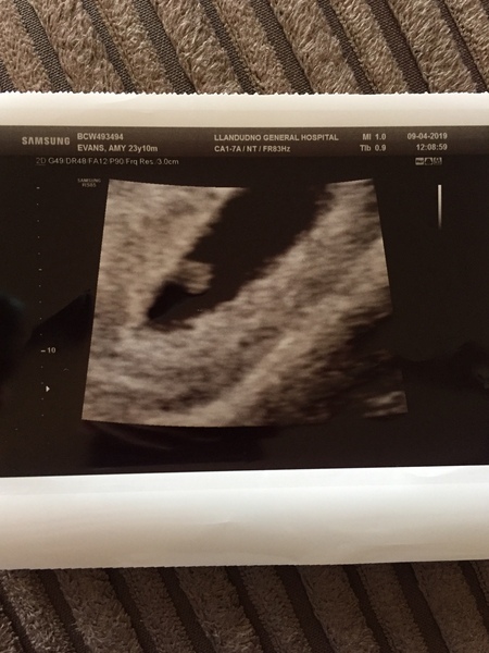 Pregnancy Ultrasounds Dates!