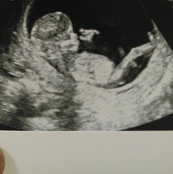 Due November 2019 Thread 4