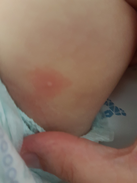 What is this??