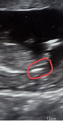 Guess the sex... just for fun