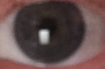 I want to ask "what colour are these eyes?"