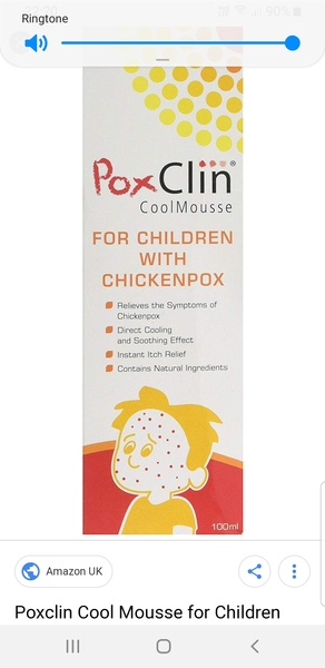 Any tips to stop chicken pox itching please?