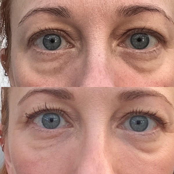 🐌 Fantastic Skincare: New Year, NuFaces