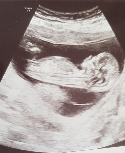Happy 5 weeks pregnant chat.Due Nov 7th!
