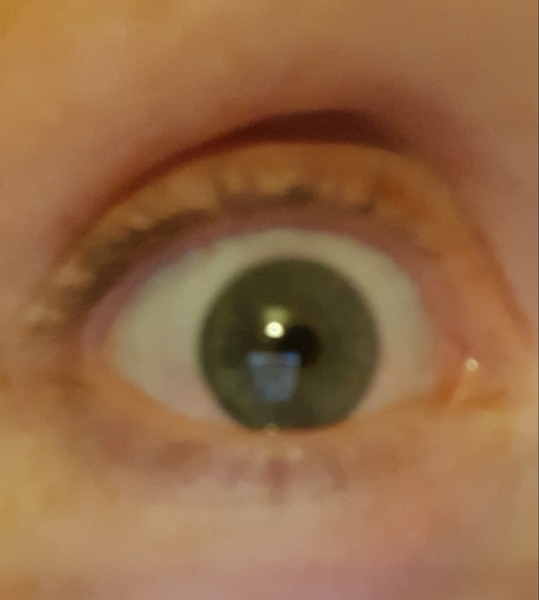 What colour eye is this? Photo attached