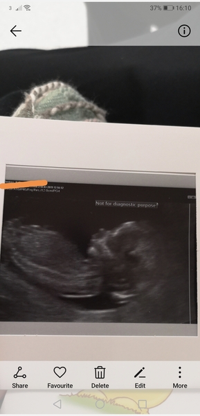 Gender guesses??