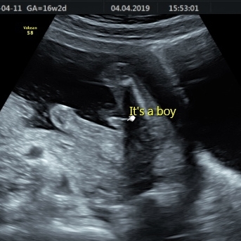 September Babies Thread #5 - we're a chatty bunch