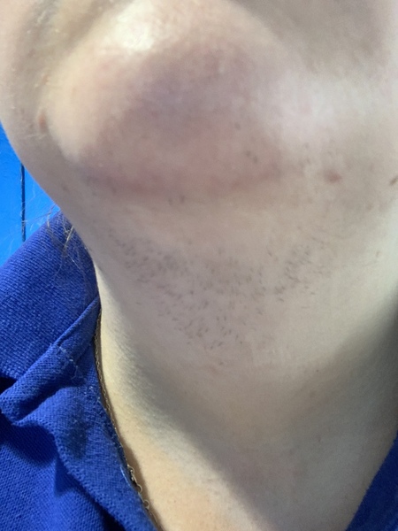 Face hair. In tears and pic included