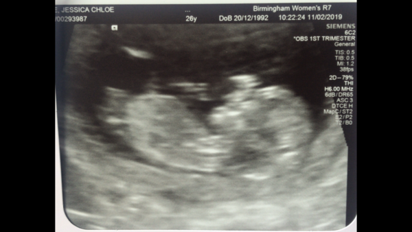 Boy or girl!? Whats your bet!