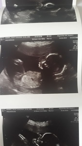 Boy or girl? Any guesses?