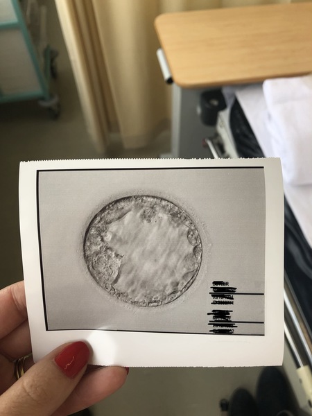 Join us here for the TMI IVF March/April/May thread