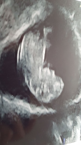 Due date 25th Oct.. who is with me?!