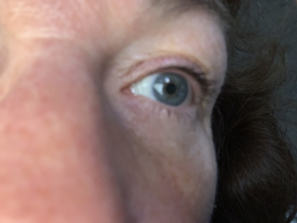 I want to ask "what colour are these eyes?"