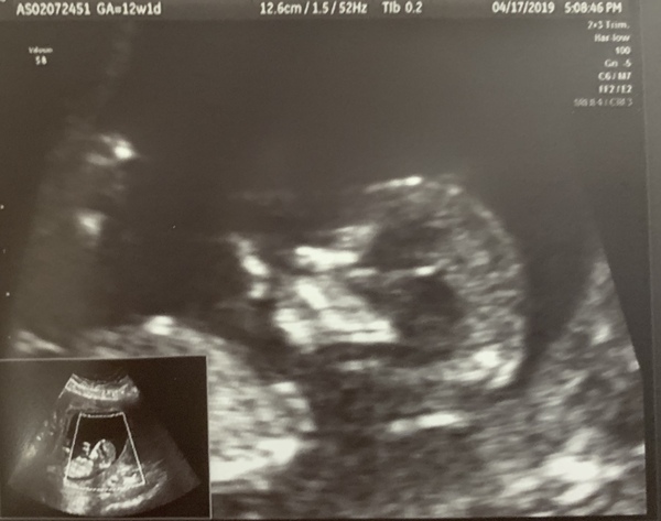 October 2019 thread 3