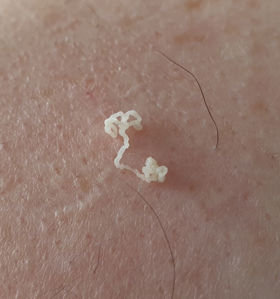 *Klaxon* DH's back spot