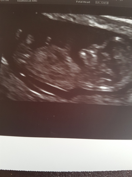 Anyone fancy a girl/boy guess?