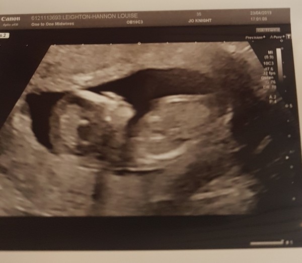 Feeling pregnant but no bfp yet