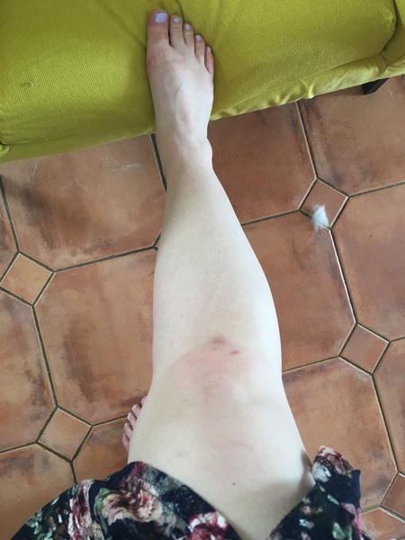 To not care about getting my pale, pale legs out?