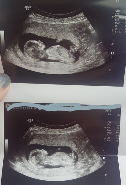 Gender guess